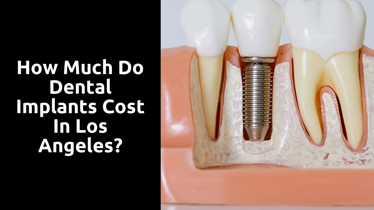 How much do dental implants cost in Los Angeles?